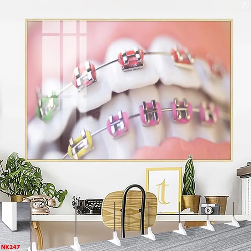 Ưu Điểm Của Tranh Tráng Gương Treo Tường Chủ Đề Hàm Răng