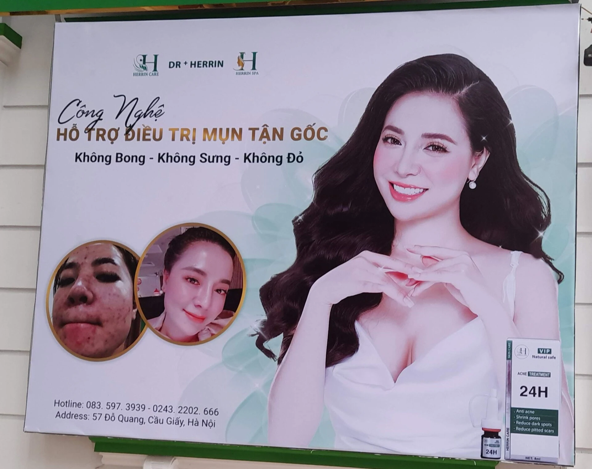 Thiết Kế Bạt Quảng Cáo Quy Nhơn 2025